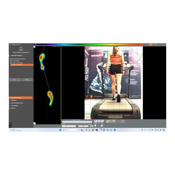 Бароподометрична бігова доріжка Sensor Medica TREADMILL RunTime XL TREADMILL RunTime XL фото
