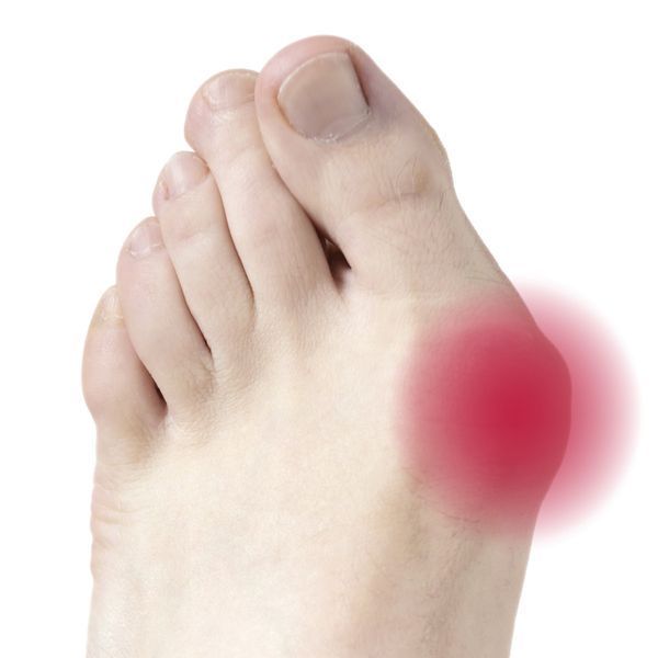 Гелевий протектор на великий палець Vitamed 5th Toe Gel Bunion Pad F-00042-09 фото